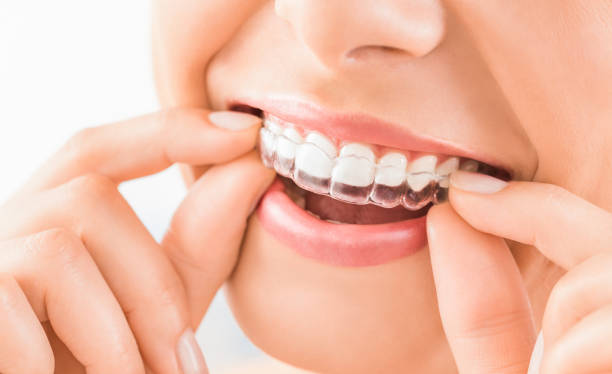 Seamless Tooth Restoration