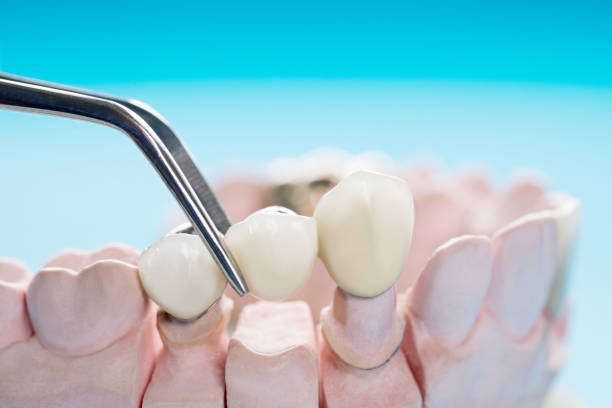 Trusted Dental Clinic in Islington