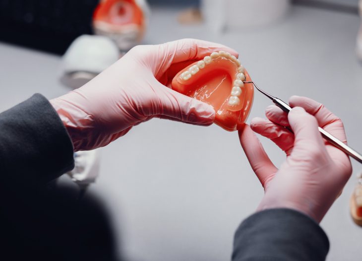 dental bridge