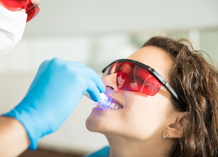 Teeth Whitening